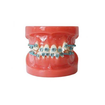 Standard Dental Model with All Metal Bracket